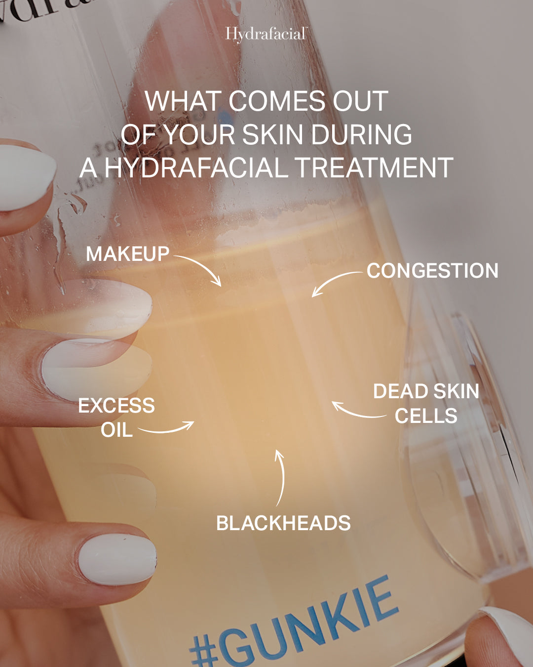 What a Hydrafacial Actually Does to Your Skin (and What It Doesn't)