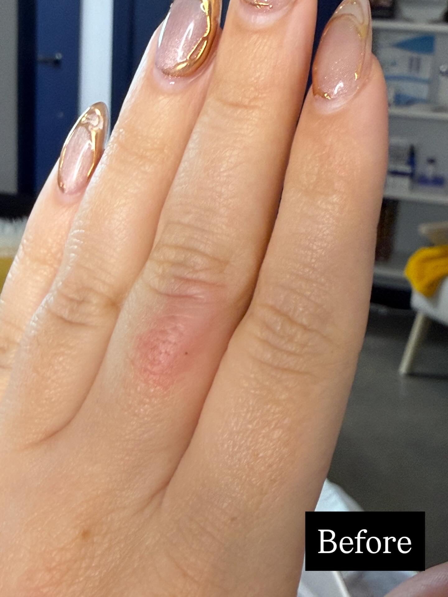 Beta-Glucan Recovery Serum