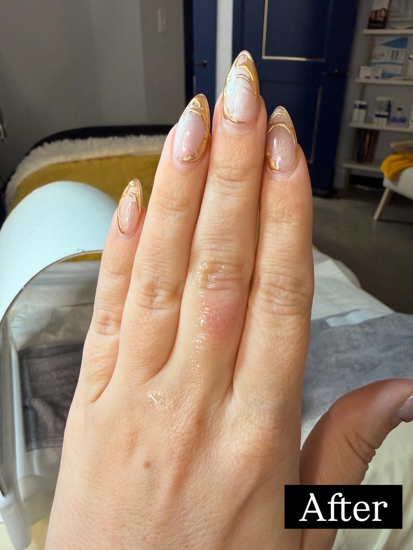 Beta-Glucan Recovery Serum